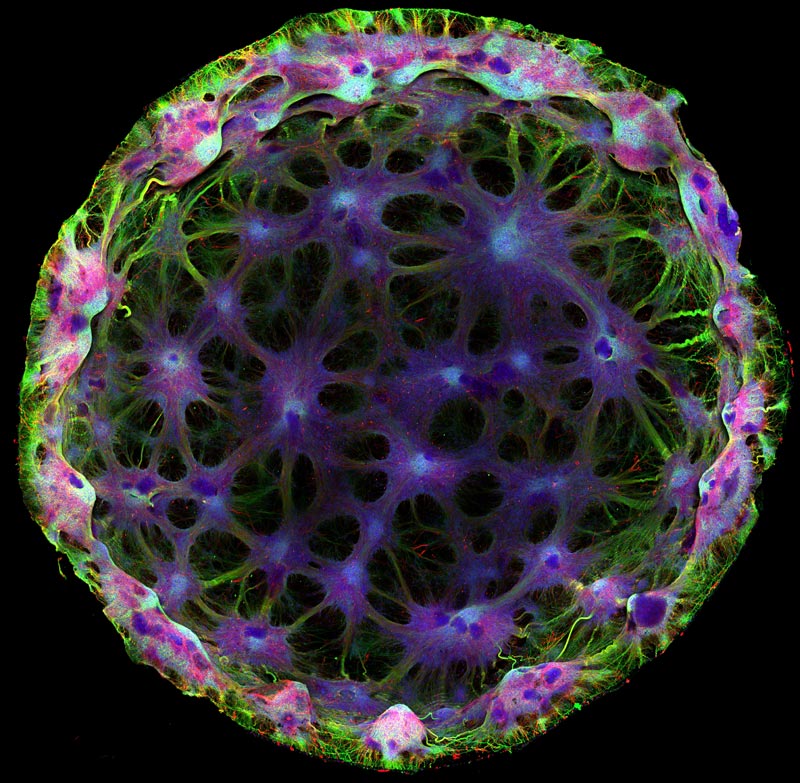 A fluorescence microscope image